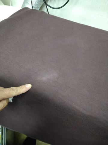 26 ニットの色抜けを直す 脱色 変色のお直し