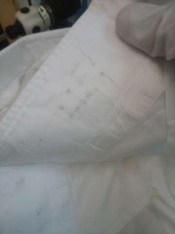 20 ワイシャツのカフスのしみ抜き